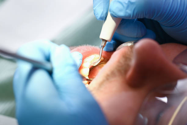 Best Emergency Tooth Extraction  in Harleysville, PA